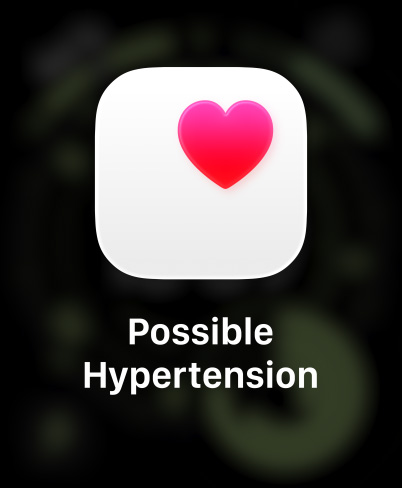 Apple Watch Ultra 3, titanové pouzdro, přírodní barva, oznámení o možné hypertenzi, růžové srdce v bílém poli, řemínek, Trailový tah, modrá / jasně modrá barva